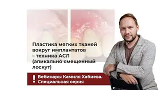 Пластика мягких тканей вокруг имплантатов – техника АСЛ