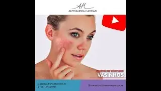 Como tratar os vasinhos avermelhados?