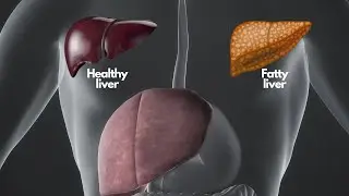 The best foods to clean your liver