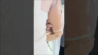 Ottobock BeBionic Hand