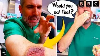 Too Gross to Handle? How to Make Edible Scabs with Operation Ouch! Do Try This At Home | CBBC