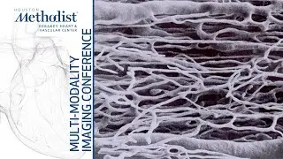 Contrast Echo (William A. Zoghbi, MD) March 15, 2022