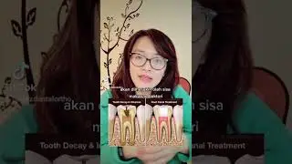 Sisa Akar Gigi Pada Anak, mesti diapain? 