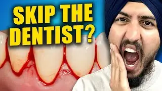 Can You Skip Your Dental Cleanings?