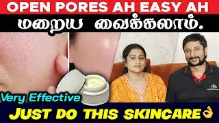 Open pores என்ன பண்ணலாம்? | Large pores in face | 👍 முகத்தில் உள்ள பள்ளம் நீங்க இதைத்தான் செய்யனும்