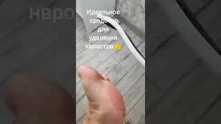 Убираем нарост на пальце #педикюр #обзор #ногти