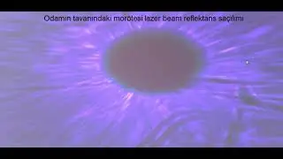 25 Km. Menzilli LIDAR Çalışmam