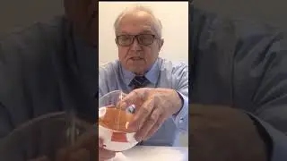 Отслоение стекловидного тела #зрение #офтальмология #офтальмолог #глаза #очки