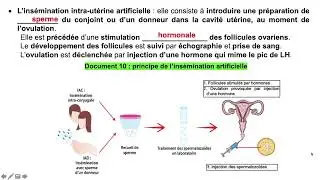 Vidéo 6 sur le chapitre 9.4.  Infertilité et aide médicale à la procréation