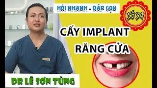Cấy implant răng cửa bao nhiêu tiền, quy trình thực hiện thế nào?