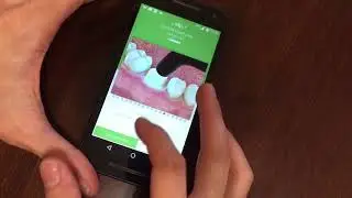 GC Luting Guide - гид по выбору материалов для фиксации (для Android)