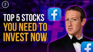 Top 5 Stocks You Need To Invest In Right Now