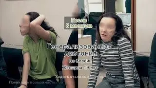 Практика лечения пациентов с дистонией