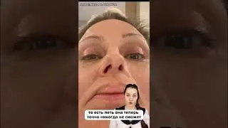Из-за филлера лишилась профессии… и ноздри 🔞