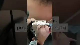 Laser SP Dynamis da Fotona