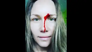 Гирудопрактика. Пиявки в каждый дом. Ч. 2