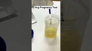 Hcg Pregnancy Test #shorts
