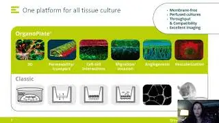 3D Cell Migration using a Microfluidic Endothelium-on-a-Chip Model