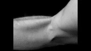 Dites STOP AUX TENDINITES