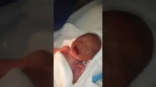 Takes first breath born at 30 weeks