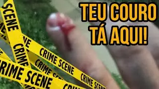 ELE TENTOU ARRANCAR MEU DEDO NA ABORDAGEM