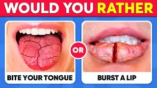 Would You Rather - HARDEST Choices Ever! 😱⚠️ Fox Quiz