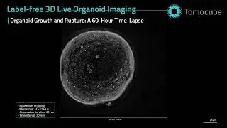 Mouse Liver Organoid Time Lapse - HT-X1 Plus Label-Free 3D Imaging
