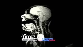 Morphometric Differences of Vocal Tract Articulators in Different Loudness Conditions in Singing