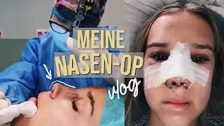 My nose job! Vlog //Hannah