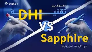 ما الفرق بين تقنيات زراعة الشعر أقلام تشوي DHI وتقنية السفير Sapphire؟ | مع د.بلوي