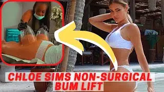 Chloe Sims Non-Surgical Bum Lift Video