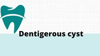 dentigerous cyst