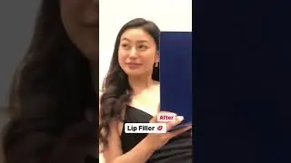 Rae Lil Black's Lip Filler 