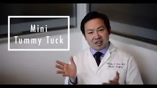 Mini Tummy Tuck Frequently Asked Questions
