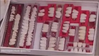 Стоматология в Индии. Не для слабонервных.