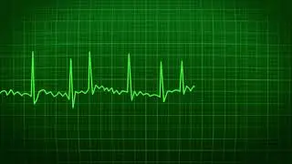Ecg Heartbeat Heart