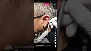 suntik vaksin ditelinga ala coki