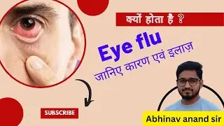 eye flu : conjunctivitis : क्यों होता है आई फ्लू? | इसके बचने के उपाय! || Abhinav Anand Sir @SERCnet