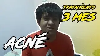 Tratamiento Acné | 3 Mes - Doxiciclina ¡AVISO IMPORTANTE!