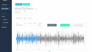 Eko Digital Stethoscope - Atrial Fibrillation
