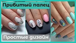 NAIL FALLING OFF/CAPRICIOUS CLIENT/SEVERAL DESIGN
