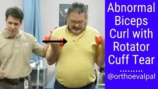 Abnormal biceps curl with rotator cuff tear
