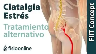 Ciática o ciatalgia y el estrés - Visión desde la medicina natural