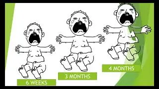 Infantile Colic: Nutrition Management. (Brian Masya).