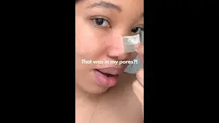 The MOST Satisfying Patch Peel 😯 Hero Cosmetics Mighty Patch Surface 
