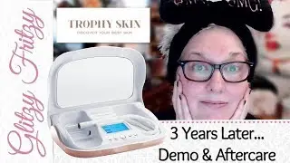 3 Years Later, Still Loving My Trophy Skin Microderm Md!