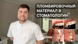 Пломбировочный материал в стоматологии – чем пломбировать зубы