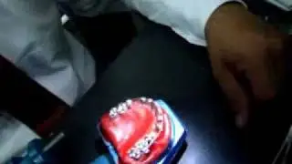 Cerrando espacios con resortes