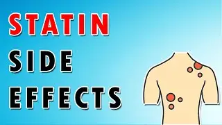 Side Effects of Statins