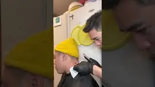 Aaron removes cyst/pimple from my neck [Time Stamp in Description to jump to the good stuff]